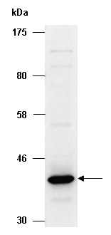 SERPINB5 Antibody Western (Abiocode)