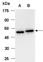 HDAC1 Antibody Western (Abiocode)