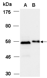 SMAD2 Antibody Western (Abiocode)
