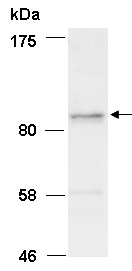 HELLS Antibody Western (Abiocode)