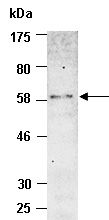 BMP3 Antibody Western (Abiocode)