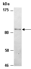 SMARCAL1 Antibody Western (Abiocode)