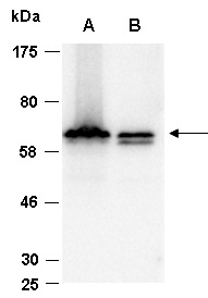 RBBP5 Antibody Western (Abiocode)