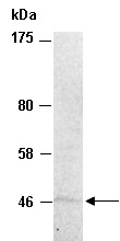 SUV39H2 Antibody Western (Abiocode)