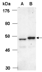 HDAC2 Antibody Western (Abiocode)