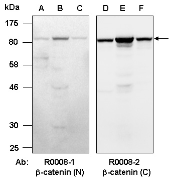 beta-catenin Antibody Western (Abiocode)