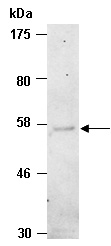 IL7Ra Antibody Western (Abiocode)