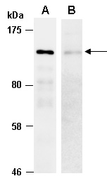 CDH1 Antibody Western (Abiocode)