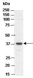 SAE1 Antibody Western (Abiocode)