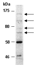 PRDM16 Antibody Western (Abiocode)