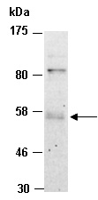 ETV6 Antibody Western (Abiocode)