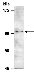 PRMT7 Antibody Western (Abiocode)