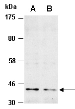 PRMT1 Antibody Western (Abiocode)