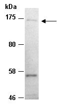 CD117 Antibody Western (Abiocode)