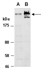 MUC1 Antibody Western (Abiocode)