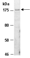 SETDB1 Antibody Western (Abiocode)