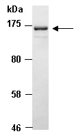 Sin3A Antibody Western (Abiocode)