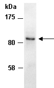CTNND1 Antibody Western (Abiocode)