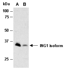ING1 Antibody Western (Abiocode)