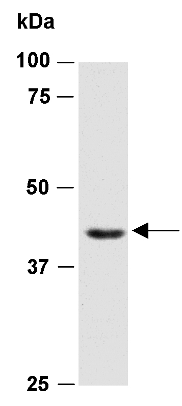 AURKB Antibody Western (Abiocode)