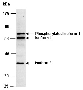 ATF2 Antibody Western (Abiocode)