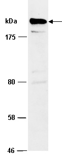 SMARCA2 Antibody Western (Abiocode)