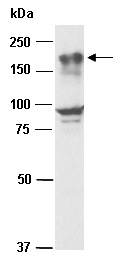 EHMT1 Antibody Western (Abiocode)