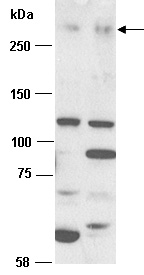 MLL2 Antibody Western (Abiocode)