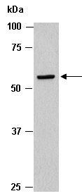 MMP13 Antibody Western (Abiocode)