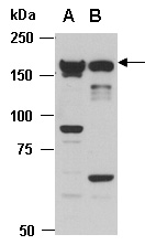 CHD5 Antibody Western (Abiocode)
