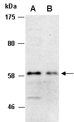 MYST1 Antibody Western (Abiocode)