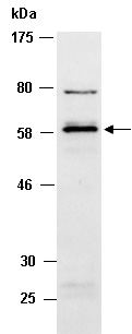 SMARCE1 Antibody Western (Abiocode)