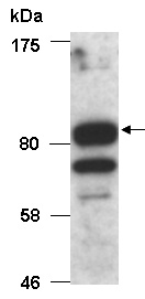 HELLS Antibody Western (Abiocode)