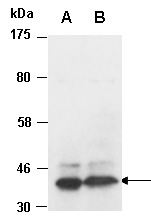 PRMT1 Antibody Western (Abiocode)