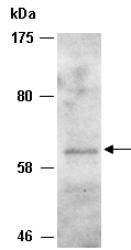PRMT3 Antibody Western (Abiocode)