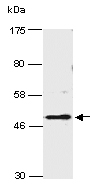 SMYD3 Antibody Western (Abiocode)