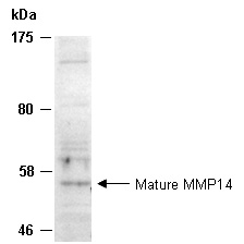 MMP14 Antibody Western (Abiocode)