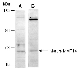 MMP14 Antibody Western (Abiocode)