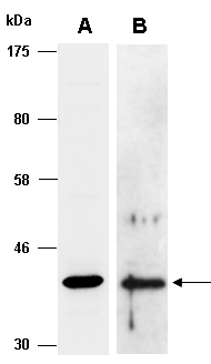 SERPINB5 Antibody Western (Abiocode)