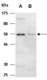 CD86 Antibody Western (Abiocode)