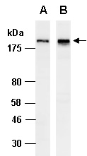 SMARCA2 Antibody Western (Abiocode)