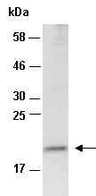 RBP4 Antibody Western (Abiocode)
