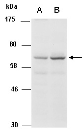 MECP2 Antibody Western (Abiocode)