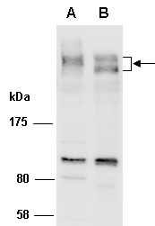 ARID1B Antibody Western (Abiocode)