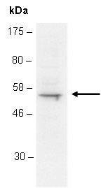 TDT Antibody Western (Abiocode)