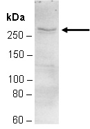 BPTF Antibody Western (Abiocode)