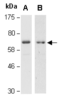 PIAS1 Antibody Western (Abiocode)