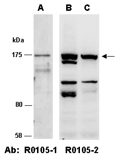 CDH2 Antibody Western (Abiocode)