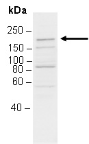 BLM Antibody Western (Abiocode)