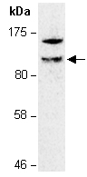 ZFP281 Antibody Western (Abiocode)